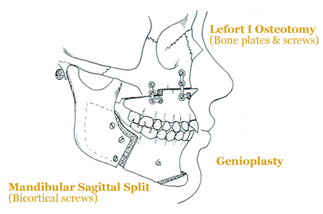 The Orthognathic Study Club logo
